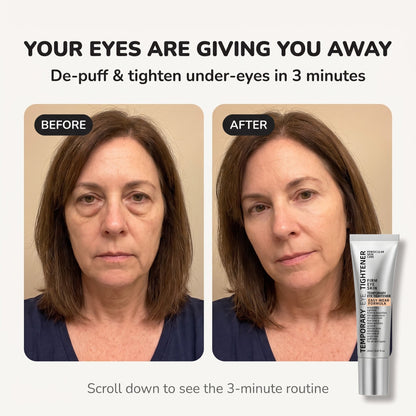 💥Reverse-Aging Eye Tightener: Younger Looking Eyes In 90 Seconds